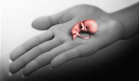 intreruperea-de-sarcina